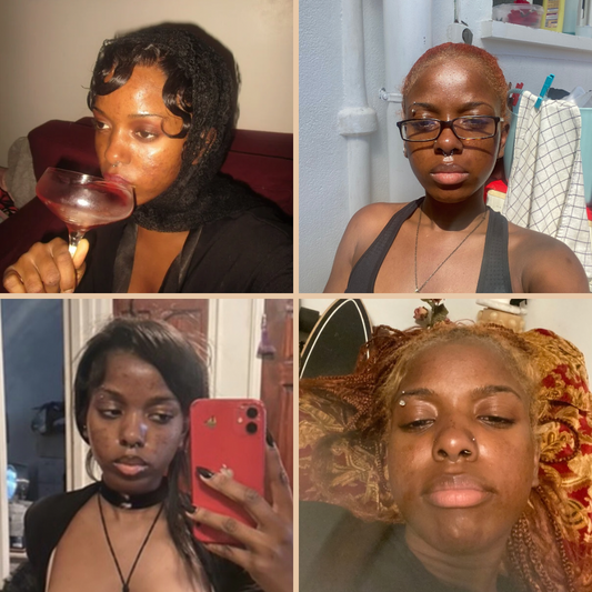 ThatJGlow Turmeric Soap