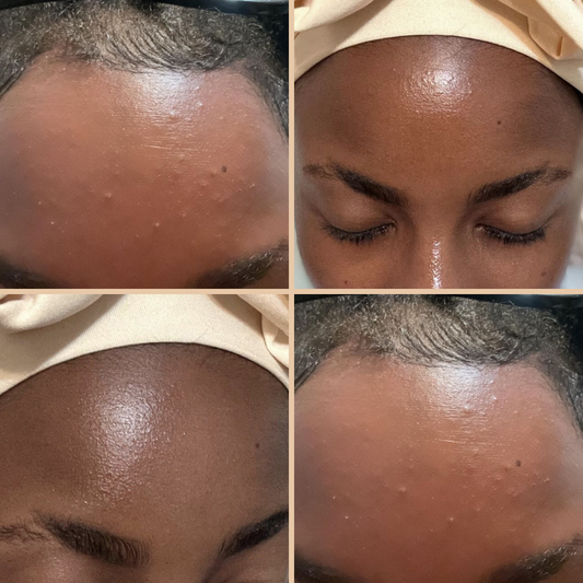 Skin Progression